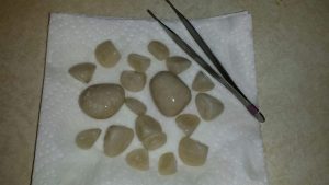 BLADDER STONES