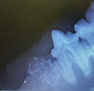 denatal x-ray