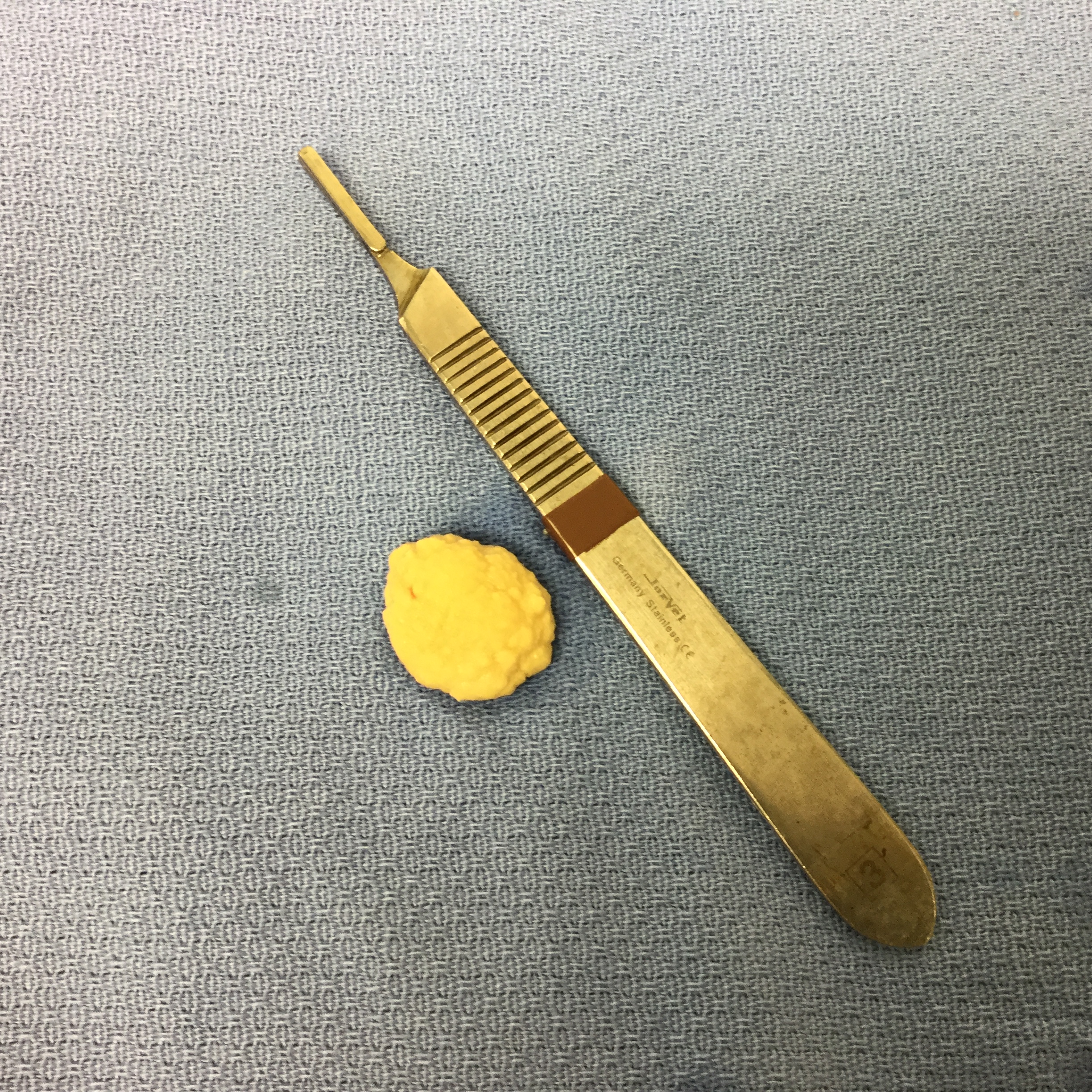 Bladder Stones