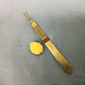 Bladder Stones