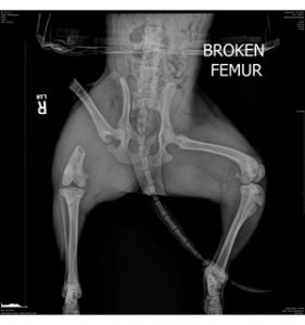 broken-femur x-ray