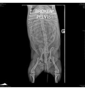 broken-pelvis x-ray